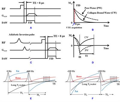 An Update in Qualitative Imaging of Bone Using Ultrashort Echo Time Magnetic Resonance